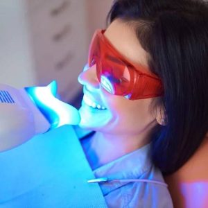 teeth whitening in Owen Sound