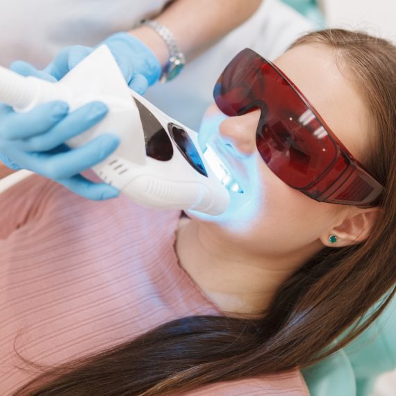 Teeth Whitening